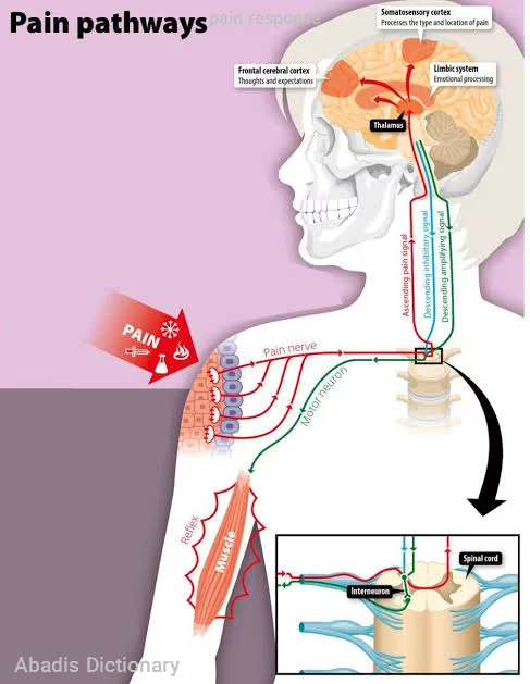 pain response